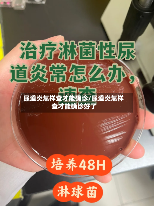 尿道炎怎样查才能确诊/尿道炎怎样查才能确诊好了