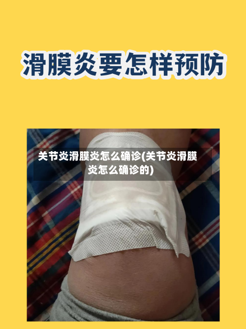 关节炎滑膜炎怎么确诊(关节炎滑膜炎怎么确诊的)