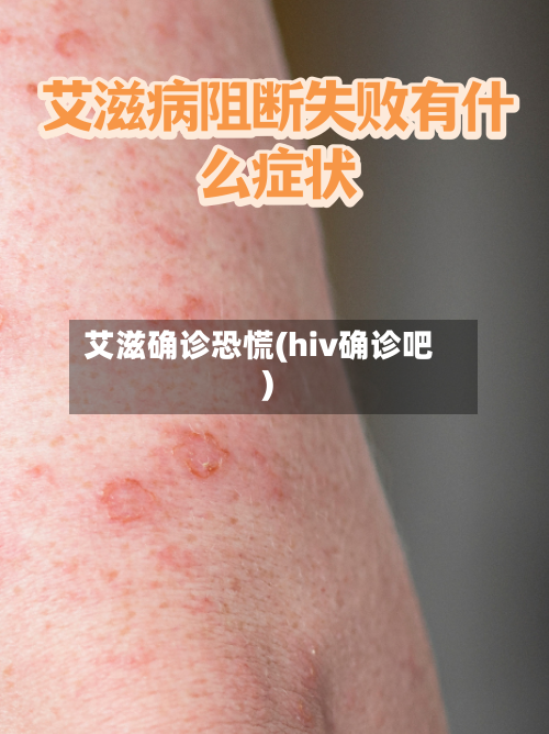 艾滋确诊恐慌(hiv确诊吧)-第2张图片