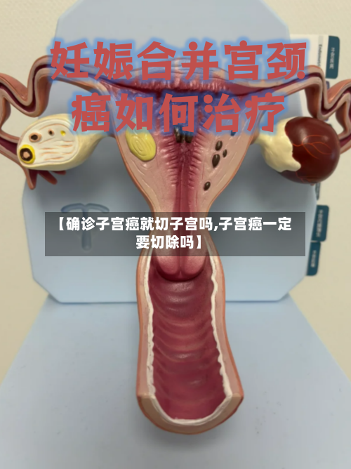 【确诊子宫癌就切子宫吗,子宫癌一定要切除吗】