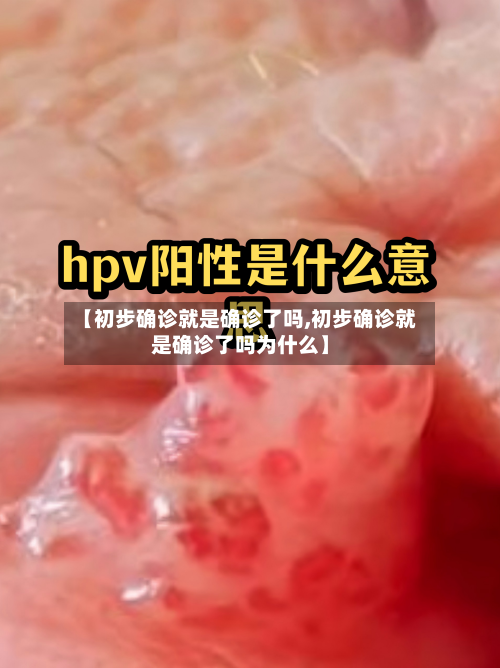 【初步确诊就是确诊了吗,初步确诊就是确诊了吗为什么】