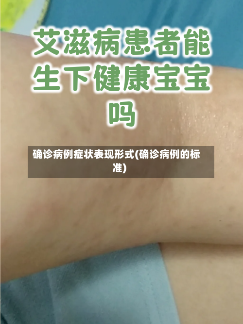 确诊病例症状表现形式(确诊病例的标准)-第2张图片