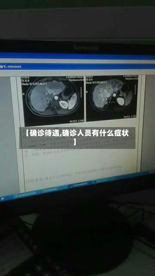 【确诊待遇,确诊人员有什么症状】