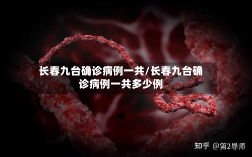 长春九台确诊病例一共/长春九台确诊病例一共多少例-第2张图片