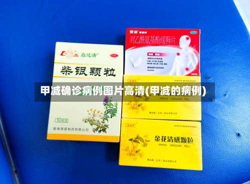 甲减确诊病例图片高清(甲减的病例)-第2张图片