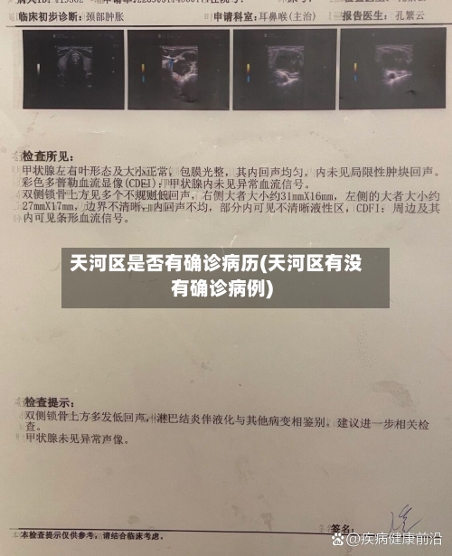 天河区是否有确诊病历(天河区有没有确诊病例)-第2张图片