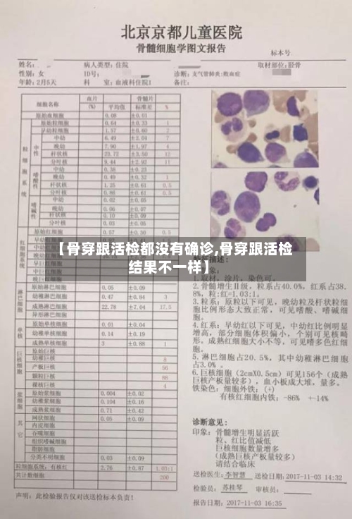 【骨穿跟活检都没有确诊,骨穿跟活检结果不一样】