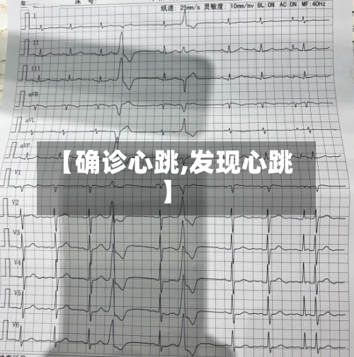 【确诊心跳,发现心跳】