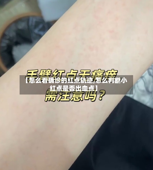 【怎么看确诊的红点轨迹,怎么判断小红点是否出血点】-第2张图片