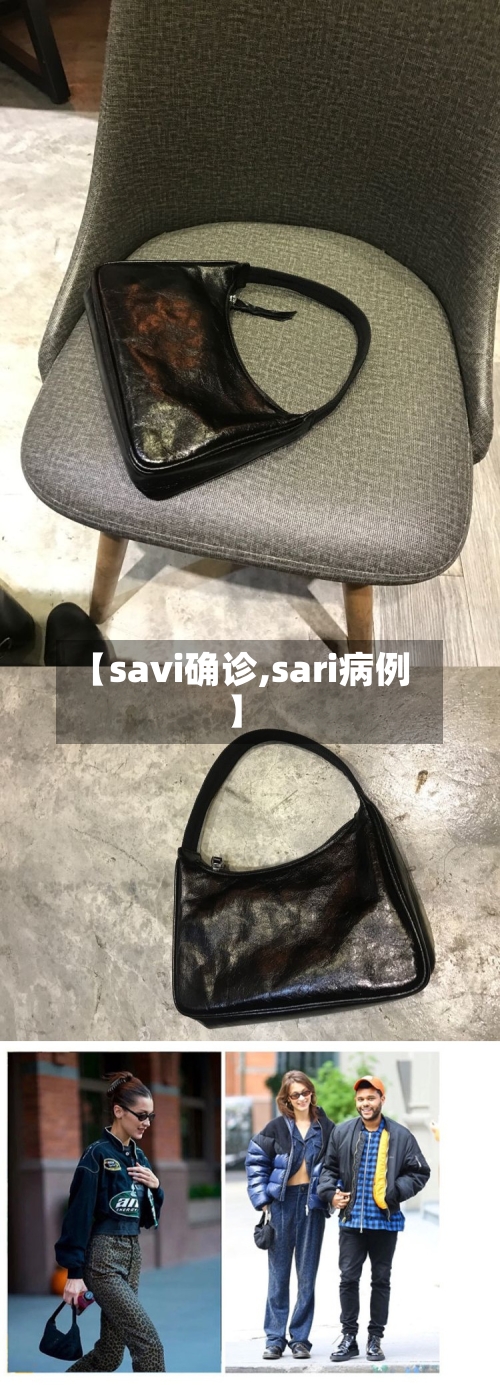 【savi确诊,sari病例】-第3张图片
